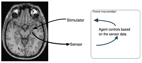 **Figure 6:** A real-time epilepsy treatment system, train using offline reinforcement learning ([157]).